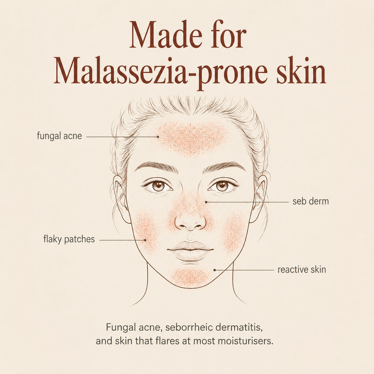 Anshin Malassezia-Safe Moisturiser